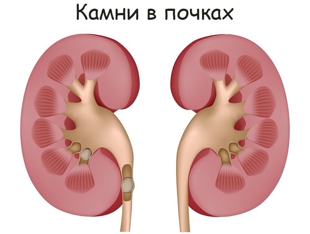 Кракен площадка торговая kr2web in